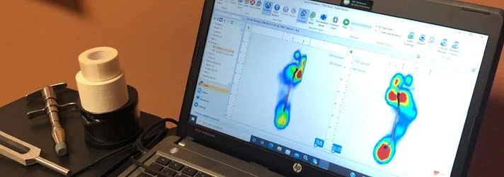 A scan of a patient's feet for custom orthotics